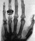 Рентген Вильгельм Конрад - фото 1